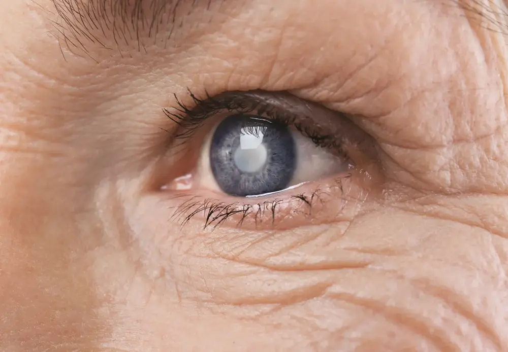 can a McCracken County, KY eye doctor diagnosis glaucoma